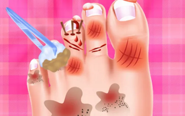 Baby Taylor Foot Treatment game thumbnail